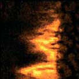 Palmitic Acid image of ion map of mouse leg: Duchenne Muscular Dystrophy Lipids
